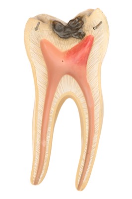 Lot 136 - A Good Didactic Model of a Molar Tooth