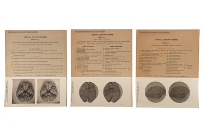 Lot 90 - Complete Set of The Edinburgh Stereoscopic Atlas of Anatomy