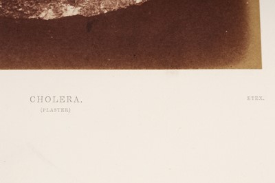 Lot 26 - Salt Print Cholera